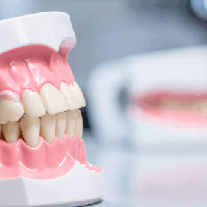 Basics in Soft Tissue Management