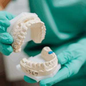 Digital Planning and Guided Surgery in Full Mouth Implant Rehabilitation