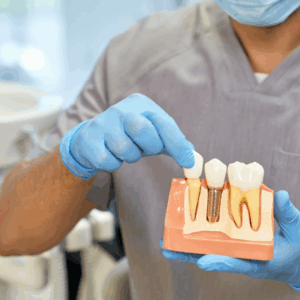 Immediate Implant Placement in the Esthetic Regio