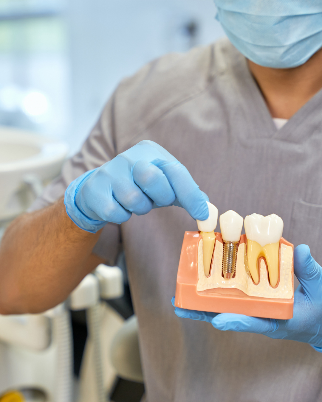 Immediate Implant Placement in the Esthetic Regio