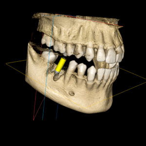CBCT Aplications and Interpretation