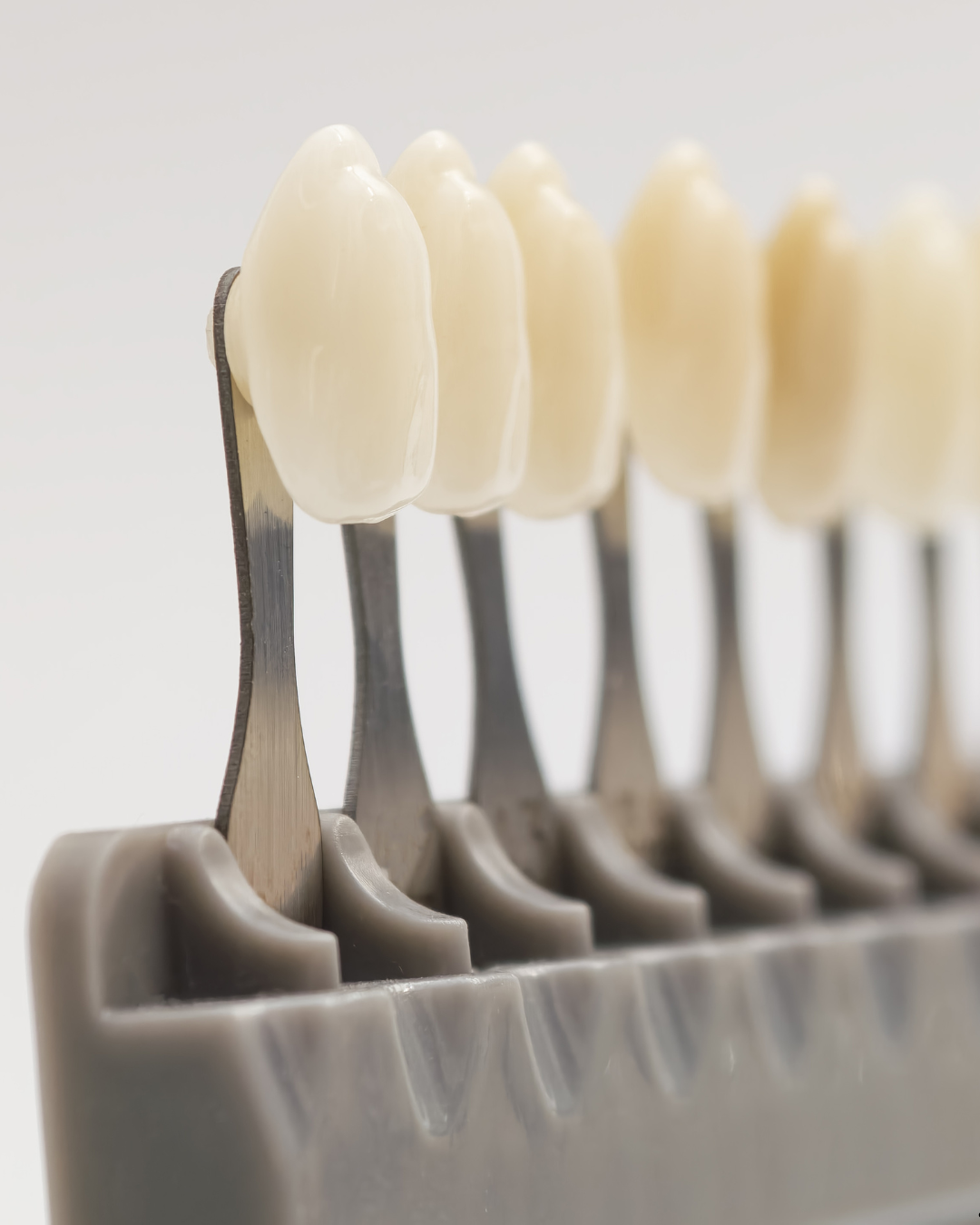 Esthetic Rehabilitation with Ceramic Veneers