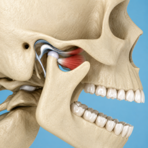 Temporomandibular Disorders & Orofacial Pain